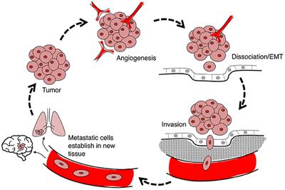 Mechanisms of Aquaporin-Facilitated Cancer Invasion and Metastasis